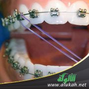 هل في تقويم الأسنان مخالفة شرعية؟